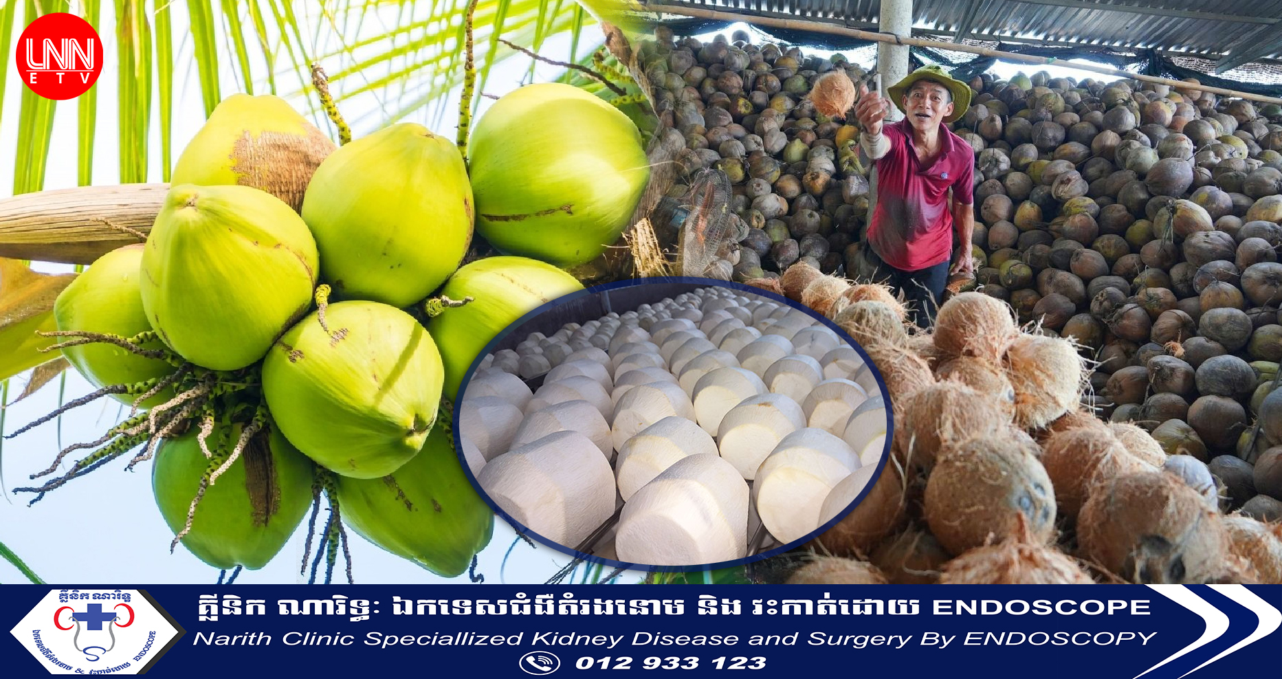 អាម៉េរិកបានអនុញ្ញាតឱ្យមានការនាំចូលដូងពីប្រទេសវៀតណាម