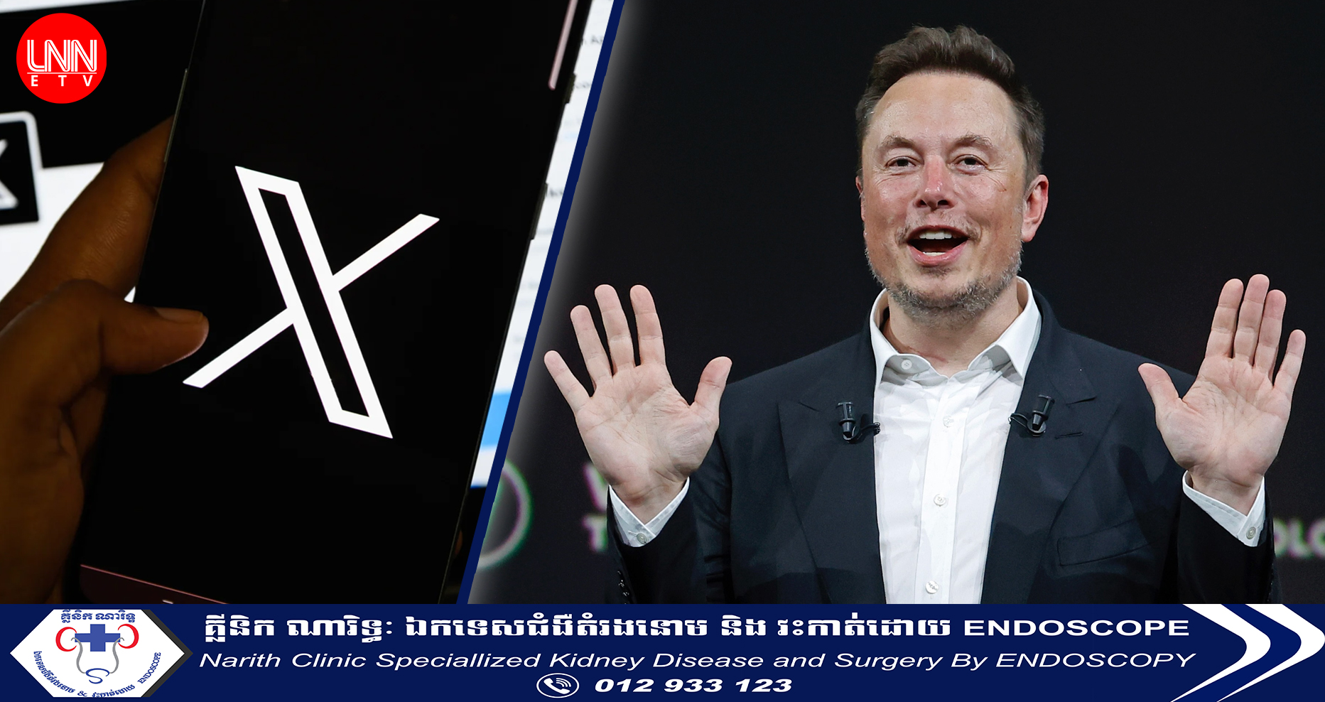 លោក Elon Musk៖ បណ្ដាញសង្គម X នឹងដកចេញនូវកម្មវិធី ដែលអាចបិទគណនីផ្សេង